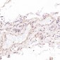 Anti-Hsp70 HSPA1A Rabbit Monoclonal Antibody